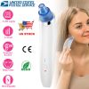 Electronic Blackhead Remover Vacuum Suction Facial Acne Pore Cleaner Blackhead Extractor Tool Device with 4 Heads