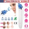 Electronic Blackhead Remover Vacuum Suction Facial Acne Pore Cleaner Blackhead Extractor Tool Device with 4 Heads